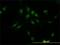 Iroquois Homeobox 5 antibody, H00010265-M01, Novus Biologicals, Immunofluorescence image 