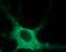Sodium Voltage-Gated Channel Alpha Subunit 9 antibody, PA5-77727, Invitrogen Antibodies, Immunocytochemistry image 