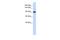 Ddx34 antibody, A10163, Boster Biological Technology, Western Blot image 