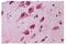 Ubiquilin 1 antibody, A00823, Boster Biological Technology, Immunohistochemistry frozen image 