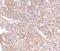 Receptor-associated protein 80 antibody, A06262, Boster Biological Technology, Immunohistochemistry paraffin image 