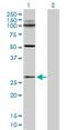 A-Kinase Interacting Protein 1 antibody, H00056672-D01P, Novus Biologicals, Western Blot image 