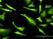ATP Binding Cassette Subfamily C Member 2 antibody, H00001244-M02, Novus Biologicals, Immunofluorescence image 