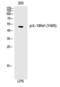 Interleukin 13 Receptor Subunit Alpha 1 antibody, PA5-40237, Invitrogen Antibodies, Western Blot image 