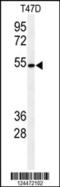 Protein O-Glucosyltransferase 1 antibody, 64-062, ProSci, Western Blot image 