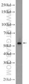 ETS Transcription Factor ERG antibody, 14356-1-AP, Proteintech Group, Western Blot image 
