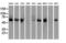 Checkpoint Kinase 2 antibody, LS-C784227, Lifespan Biosciences, Western Blot image 