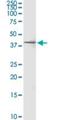 Regulation Of Nuclear Pre-MRNA Domain Containing 1B antibody, H00058490-M04, Novus Biologicals, Western Blot image 