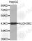 Aldehyde Dehydrogenase 3 Family Member B2 antibody, A3726, ABclonal Technology, Western Blot image 