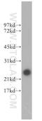 T-Complex 10 Like antibody, 13709-1-AP, Proteintech Group, Western Blot image 