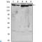 RPTOR Independent Companion Of MTOR Complex 2 antibody, LS-C812760, Lifespan Biosciences, Western Blot image 