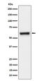 Folylpolyglutamate Synthase antibody, M02836, Boster Biological Technology, Western Blot image 