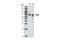 Protein Inhibitor Of Activated STAT 4 antibody, 4392T, Cell Signaling Technology, Western Blot image 