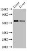 ETS Variant 1 antibody, LS-C670138, Lifespan Biosciences, Western Blot image 