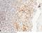 Protein Tyrosine Phosphatase Non-Receptor Type 1 antibody, 10304-RP02, Sino Biological, Immunohistochemistry frozen image 