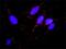 MDM2 Proto-Oncogene antibody, H00004193-M01, Novus Biologicals, Proximity Ligation Assay image 