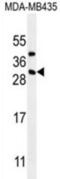 CD8b Molecule antibody, abx026526, Abbexa, Western Blot image 