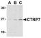 C1q And TNF Related 7 antibody, NBP1-76635, Novus Biologicals, Western Blot image 