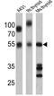 Thyroid Hormone Receptor Alpha antibody, GTX25621, GeneTex, Western Blot image 