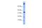 Family With Sequence Similarity 178 Member B antibody, GTX45002, GeneTex, Western Blot image 