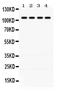 PTPN22 antibody, PB9784, Boster Biological Technology, Western Blot image 