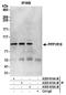 Protein Phosphatase 1 Regulatory Subunit 18 antibody, A305-616A-M, Bethyl Labs, Immunoprecipitation image 