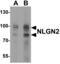 Neuroligin 2 antibody, MBS153592, MyBioSource, Western Blot image 