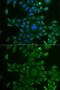 Kynurenine Aminotransferase 1 antibody, GTX32492, GeneTex, Immunocytochemistry image 