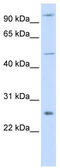 TNF Receptor Associated Factor 4 antibody, TA330396, Origene, Western Blot image 