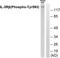 Colony Stimulating Factor 2 Receptor Beta Common Subunit antibody, LS-C199114, Lifespan Biosciences, Western Blot image 