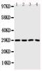 Carbonic Anhydrase 3 antibody, PA1439, Boster Biological Technology, Western Blot image 