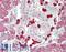 Amylase Alpha 1C (Salivary) antibody, LS-B15829, Lifespan Biosciences, Immunohistochemistry paraffin image 