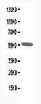 AChR alpha 1 antibody, PA1203, Boster Biological Technology, Western Blot image 