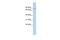 Zinc Finger Protein 800 antibody, A14996, Boster Biological Technology, Western Blot image 