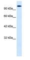 Homeodomain Interacting Protein Kinase 2 antibody, ab28507, Abcam, Western Blot image 