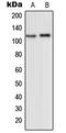 Glutamate Metabotropic Receptor 2 antibody, LS-C352290, Lifespan Biosciences, Western Blot image 