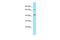Parathyroid Hormone 2 Receptor antibody, A10343, Boster Biological Technology, Western Blot image 