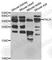 Prostate Stem Cell Antigen antibody, A5614, ABclonal Technology, Western Blot image 