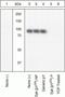 Spleen Associated Tyrosine Kinase antibody, GTX12862, GeneTex, Western Blot image 