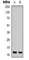 Interferon Induced Transmembrane Protein 1 antibody, abx133551, Abbexa, Western Blot image 