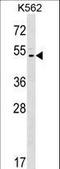 HINaC antibody, LS-C160994, Lifespan Biosciences, Western Blot image 