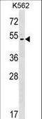 Acid Sensing Ion Channel Subunit Family Member 5 antibody, LS-C160994, Lifespan Biosciences, Western Blot image 