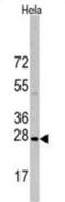 Heat Shock Protein Family B (Small) Member 1 antibody, abx033221, Abbexa, Western Blot image 