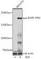 EGFR antibody, A00023Y992, Boster Biological Technology, Western Blot image 