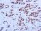 Androgen Receptor antibody, GTX29474, GeneTex, Immunohistochemistry paraffin image 