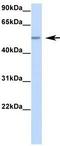 RNA Binding Motif Protein 47 antibody, GTX47272, GeneTex, Western Blot image 