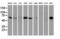Epsin 2 antibody, LS-C337629, Lifespan Biosciences, Western Blot image 