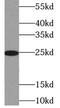 Thymidine Kinase 1 antibody, FNab08718, FineTest, Western Blot image 
