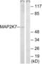 Mitogen-Activated Protein Kinase Kinase 7 antibody, LS-C118313, Lifespan Biosciences, Western Blot image 