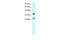 Asialoglycoprotein Receptor 2 antibody, 27-957, ProSci, Western Blot image 